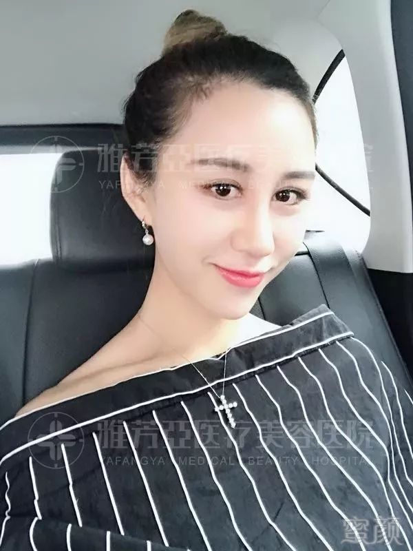 https://img.miyanlife.com/mnt/timg/180529/104319C38-7.jpg