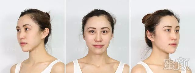 https://img.miyanlife.com/mnt/timg/180529/10431S0V-2.jpg