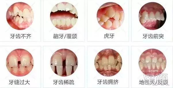 https://img.miyanlife.com/mnt/timg/180529/1051263638-2.jpg
