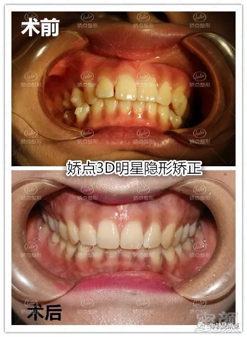https://img.miyanlife.com/mnt/timg/180529/1051315324-7.jpg