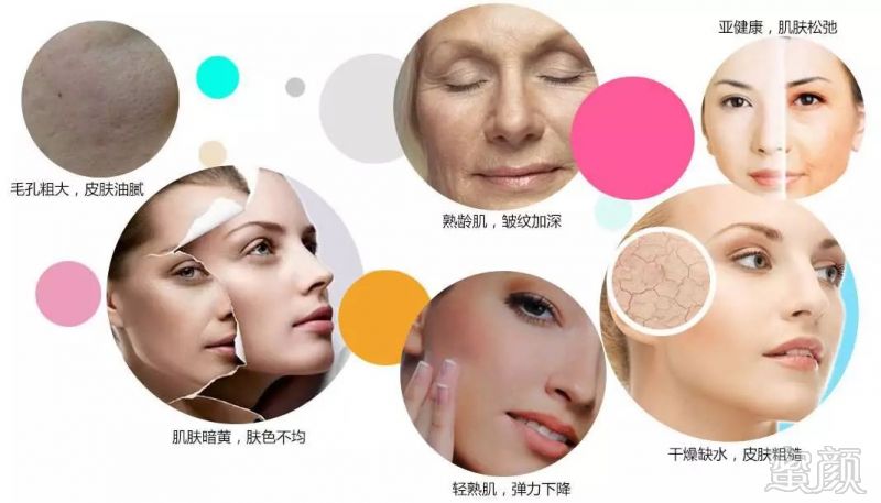 https://img.miyanlife.com/mnt/timg/180529/110G63096-4.jpg