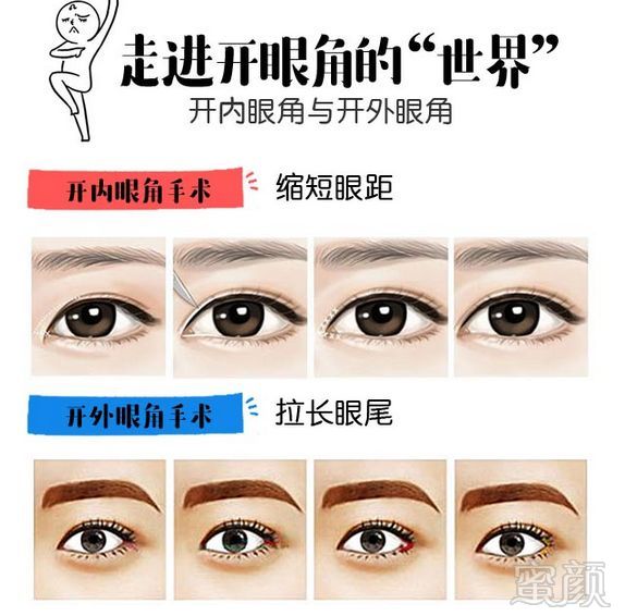 https://img.miyanlife.com/mnt/timg/180529/1125132964-4.jpg