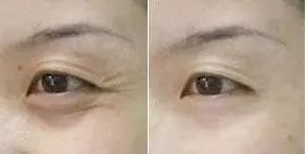 https://img.miyanlife.com/mnt/timg/180529/120A5B17-5.jpg