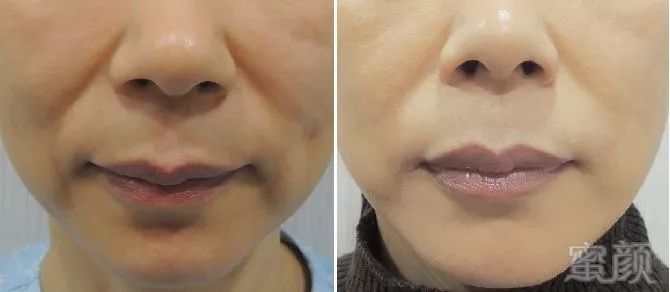 https://img.miyanlife.com/mnt/timg/180529/120A63R8-8.jpg