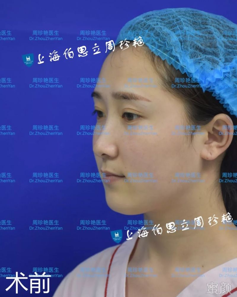 https://img.miyanlife.com/mnt/timg/180529/1210092917-1.jpg