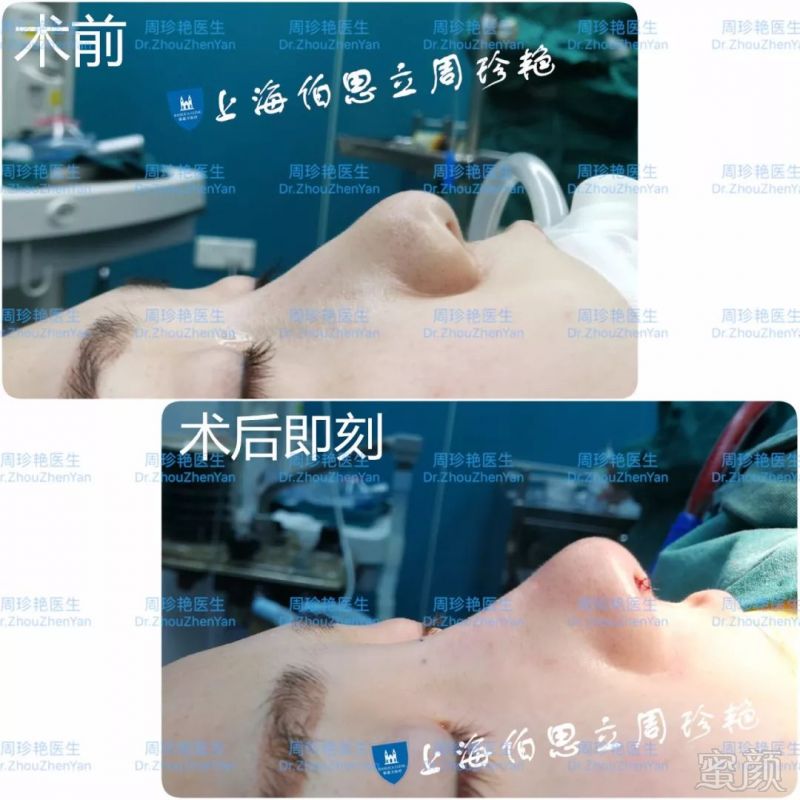 https://img.miyanlife.com/mnt/timg/180529/1210103230-2.jpg