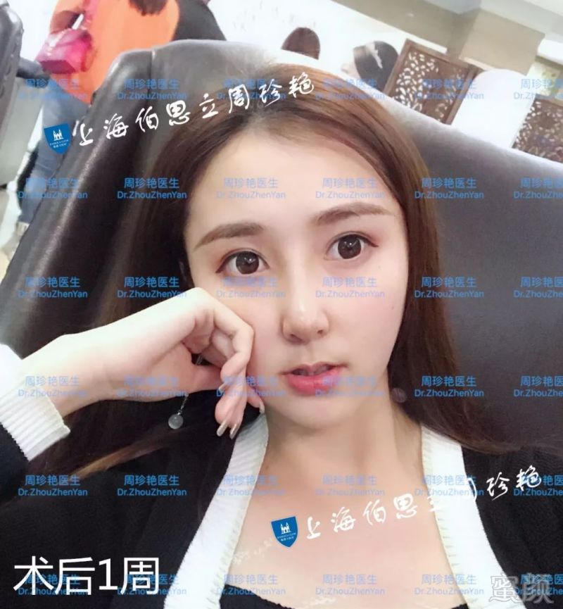 https://img.miyanlife.com/mnt/timg/180529/1210104H3-3.jpg