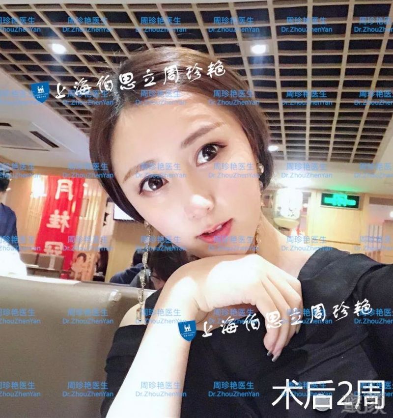 https://img.miyanlife.com/mnt/timg/180529/1210134092-7.jpg