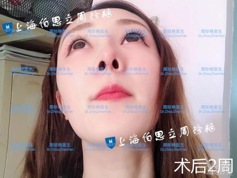 https://img.miyanlife.com/mnt/timg/180529/1210143323-9.jpg