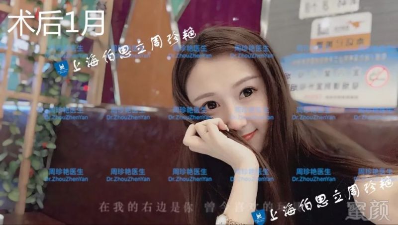 https://img.miyanlife.com/mnt/timg/180529/1210161304-12.jpg