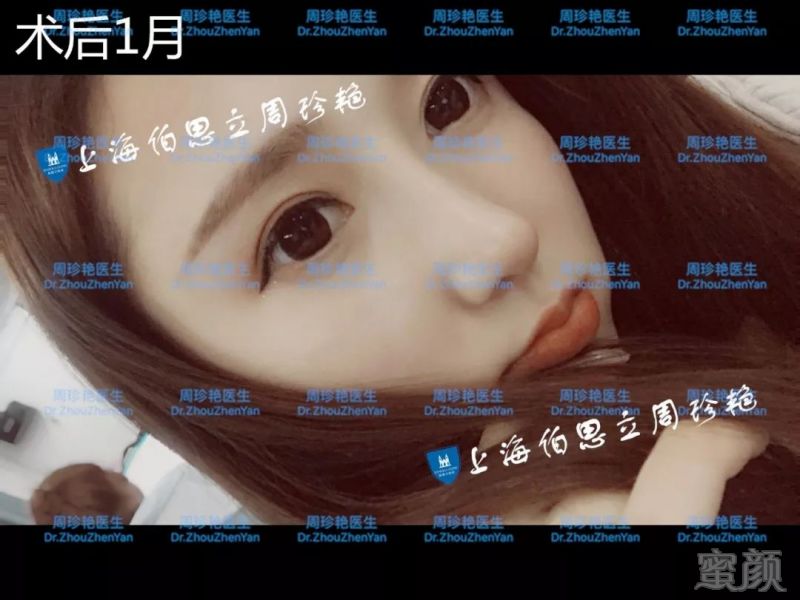 https://img.miyanlife.com/mnt/timg/180529/12101L3M-13.jpg