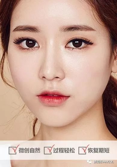 https://img.miyanlife.com/mnt/timg/180530/103R64D3-0.jpg