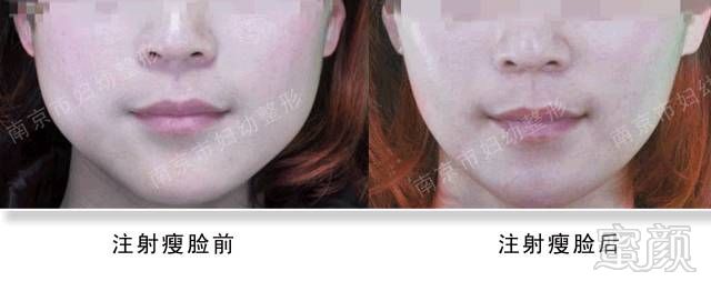 https://img.miyanlife.com/mnt/timg/180530/10400121M-4.jpg