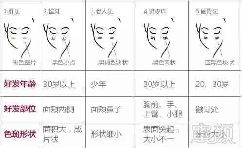 https://img.miyanlife.com/mnt/timg/180530/1122334161-3.jpg