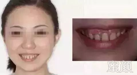 https://img.miyanlife.com/mnt/timg/180530/1129334X1-3.jpg