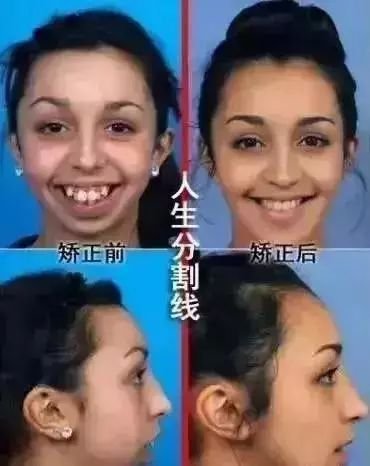 https://img.miyanlife.com/mnt/timg/180530/112933G21-6.jpg