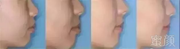 https://img.miyanlife.com/mnt/timg/180530/11293VS0-11.jpg
