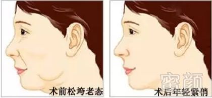 https://img.miyanlife.com/mnt/timg/180530/112S42939-4.jpg