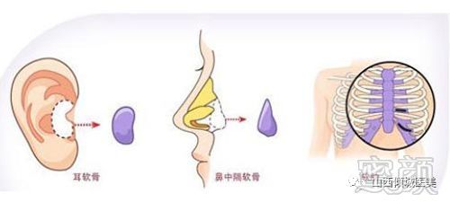 https://img.miyanlife.com/mnt/timg/180530/11560aD0-5.jpg