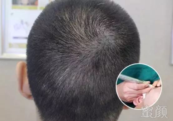 https://img.miyanlife.com/mnt/timg/180530/115I12W2-5.jpg