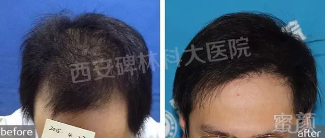 https://img.miyanlife.com/mnt/timg/180530/115I21193-9.jpg