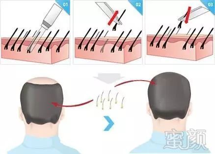 https://img.miyanlife.com/mnt/timg/180530/115I22625-7.jpg