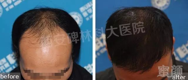 https://img.miyanlife.com/mnt/timg/180530/115I2D06-8.jpg