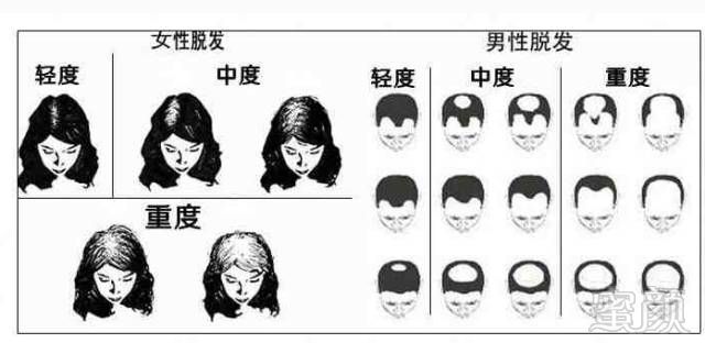 https://img.miyanlife.com/mnt/timg/180530/1210496308-2.jpg