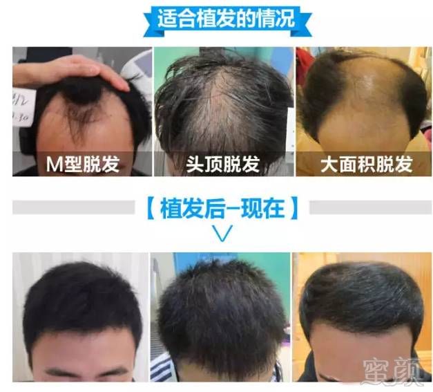 https://img.miyanlife.com/mnt/timg/180530/12105064a-7.jpg