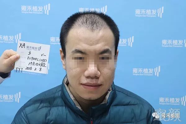 https://img.miyanlife.com/mnt/timg/180530/12121L4K-9.jpg