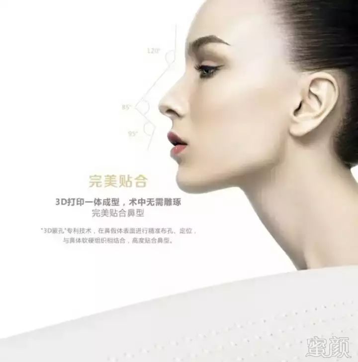 https://img.miyanlife.com/mnt/timg/180530/12160420J-3.jpg