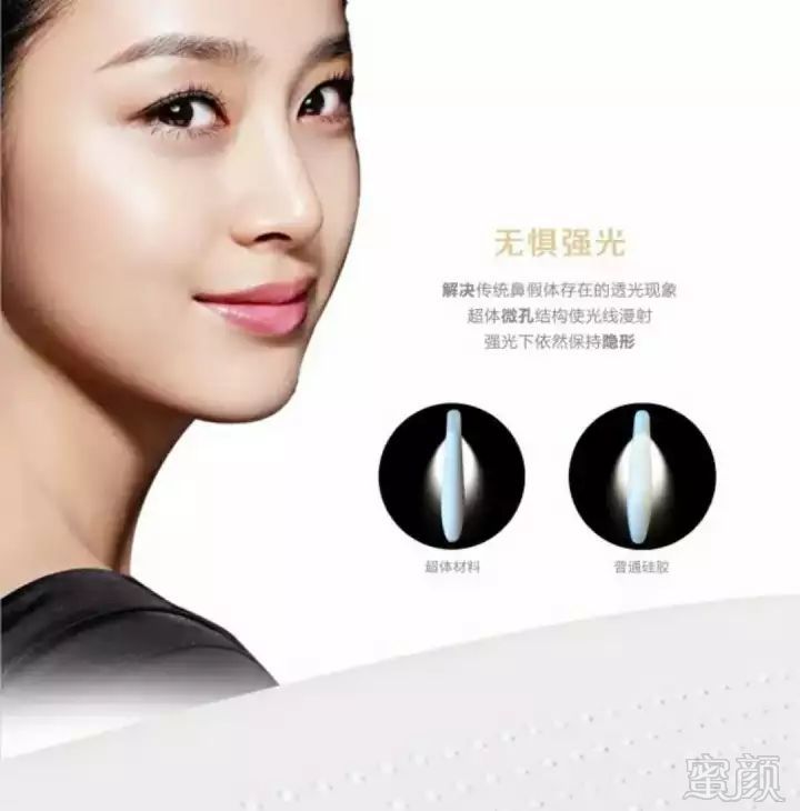 https://img.miyanlife.com/mnt/timg/180530/1216052250-6.jpg
