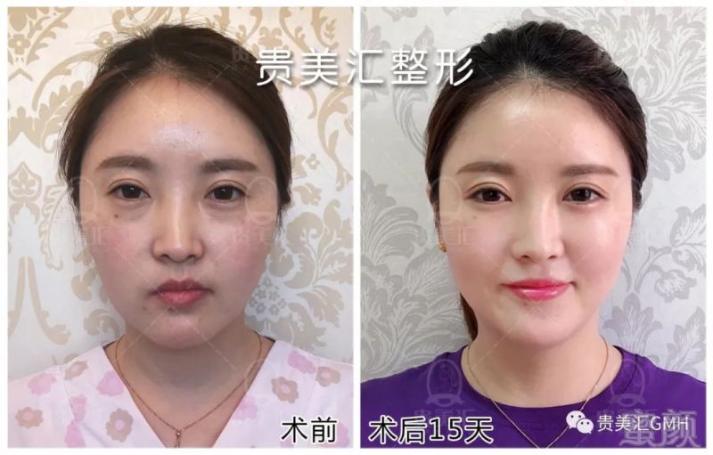 https://img.miyanlife.com/mnt/timg/180530/121R23624-3.jpg