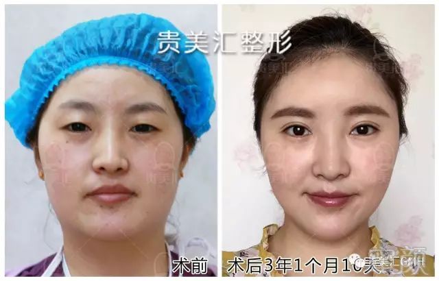 https://img.miyanlife.com/mnt/timg/180530/121R2I00-2.jpg