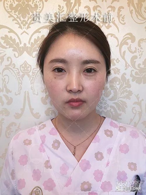 https://img.miyanlife.com/mnt/timg/180530/121R31312-4.jpg