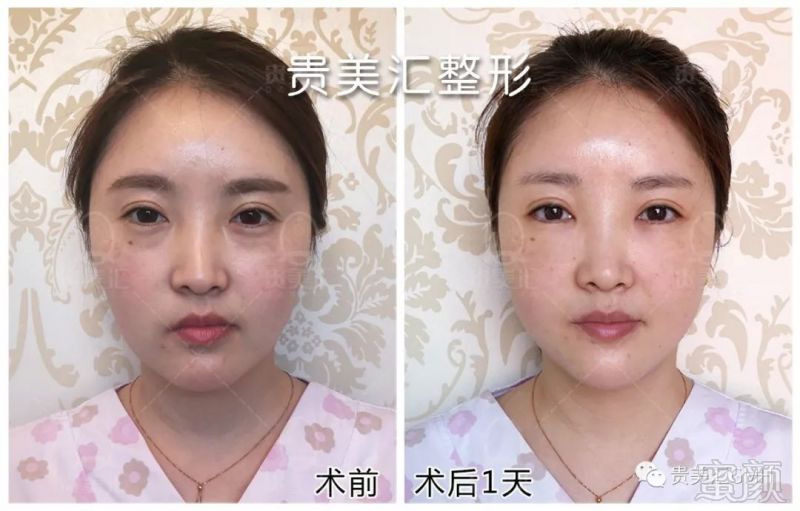 https://img.miyanlife.com/mnt/timg/180530/121R44943-7.jpg