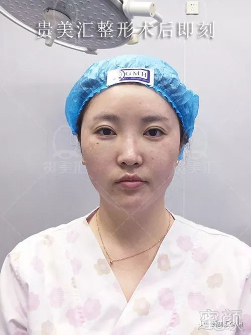 https://img.miyanlife.com/mnt/timg/180530/121R45R2-6.jpg