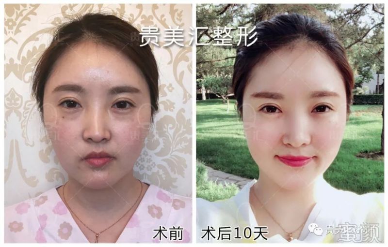 https://img.miyanlife.com/mnt/timg/180530/121R51142-9.jpg