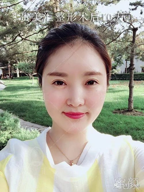 https://img.miyanlife.com/mnt/timg/180530/121R514L-10.jpg