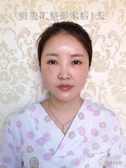https://img.miyanlife.com/mnt/timg/180530/121R5N32-8.jpg
