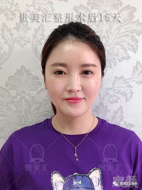 https://img.miyanlife.com/mnt/timg/180530/121R63261-12.jpg