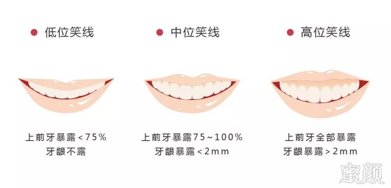 https://img.miyanlife.com/mnt/timg/180530/12244K096-1.jpg