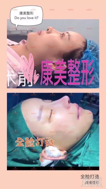 https://img.miyanlife.com/mnt/timg/180530/1225535b4-3.jpg
