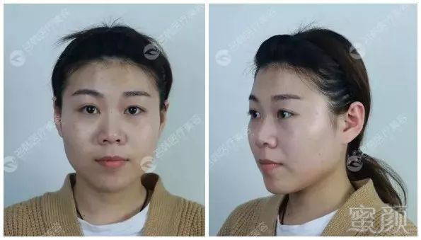https://img.miyanlife.com/mnt/timg/180530/12321R091-6.jpg