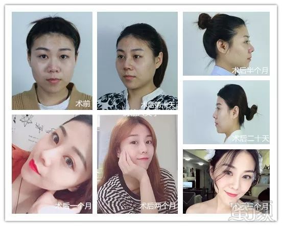 https://img.miyanlife.com/mnt/timg/180530/12322230N-10.jpg