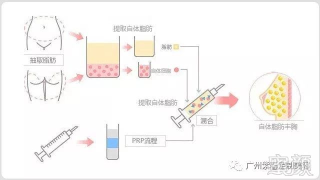 案例图片