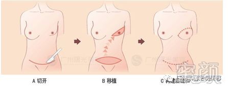 案例图片