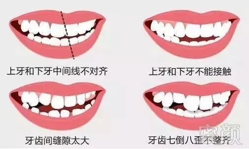 https://img.miyanlife.com/mnt/timg/180530/123R63248-2.jpg