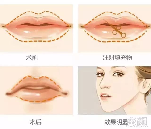 https://img.miyanlife.com/mnt/timg/180530/1311144W1-10.jpg