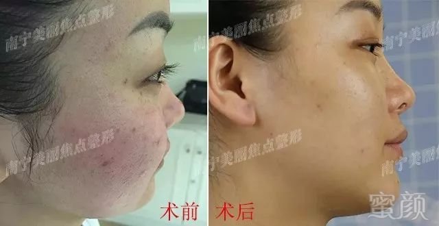 https://img.miyanlife.com/mnt/timg/180530/1415032136-3.jpg
